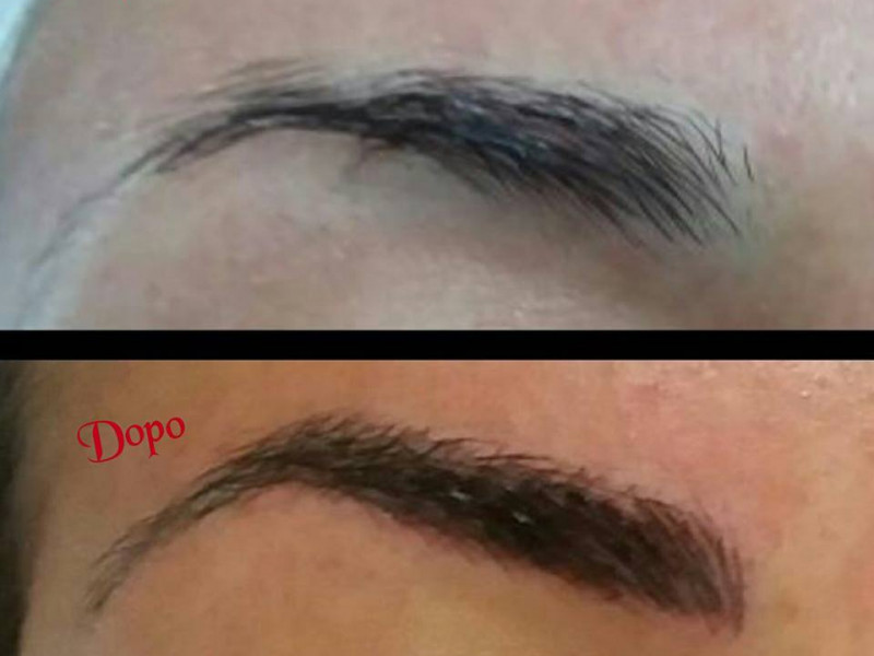 MicroBlading